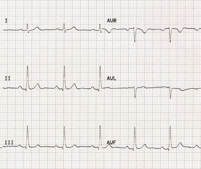 limblead1.jpg