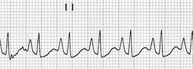 p-pulmonale1.jpg